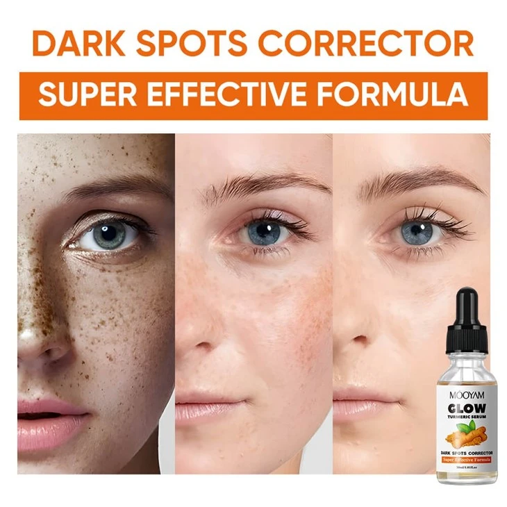 MOOYAM 30ML ANTI-AGING GLOW TURMERIC SERUM